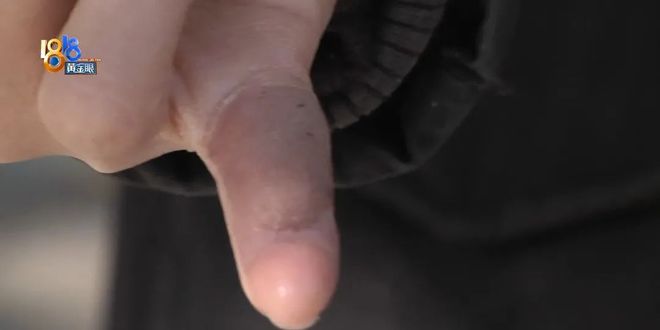 间晕厥筋都断了……街上常见看见立即远离j9九游会真人游戏第一后怕！5岁男童瞬