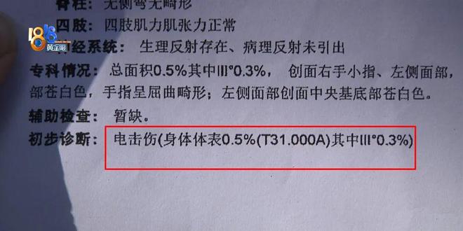 间晕厥筋都断了……街上常见看见立即远离j9九游会真人游戏第一后怕！5岁男童瞬(图7)